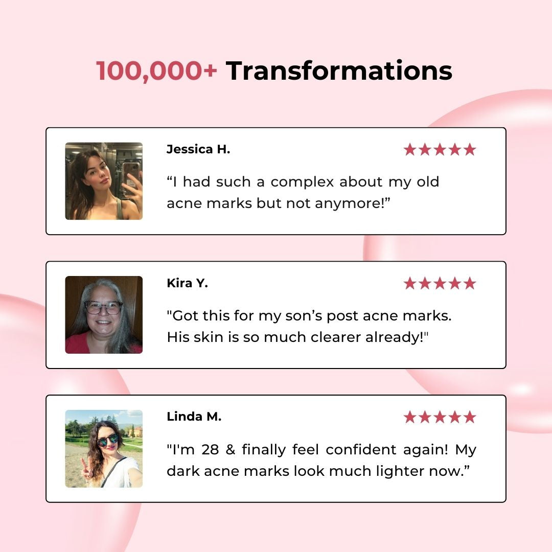 Acne Marks Corrector